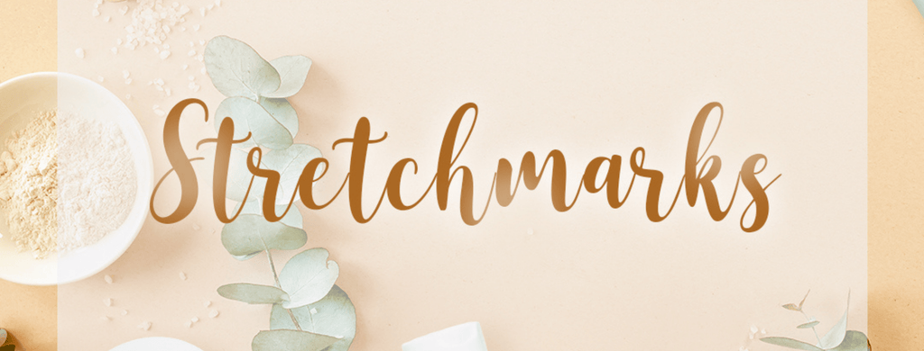All You Need To Know About Stretchmarks And What You Can Do About It