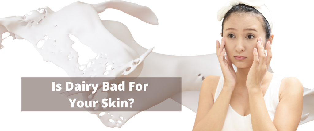 Is Consuming Dairy a Direct Cause to Acne and Other Skin Issues?