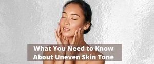 Say Goodbye to Dark Spots- Guide to Improve Hyperpigmentation