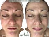 Spring Forward Radiant Skin Facial Protocol Bundle